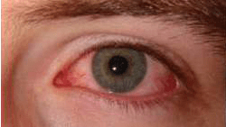 глаза после наркотиков